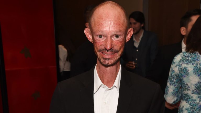 Darren Kent Aktor Game Of Thrones Meninggal Dunia Pada Jumat 11 Agustus